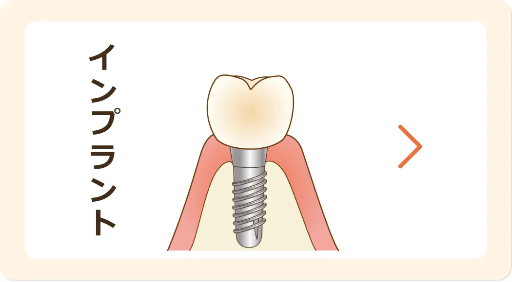 インプラント