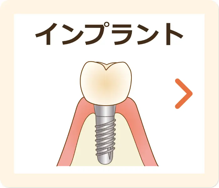 インプラント