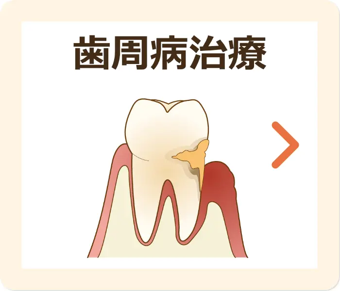 歯周病治療
