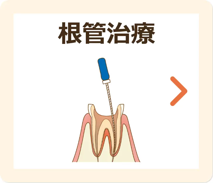根管治療